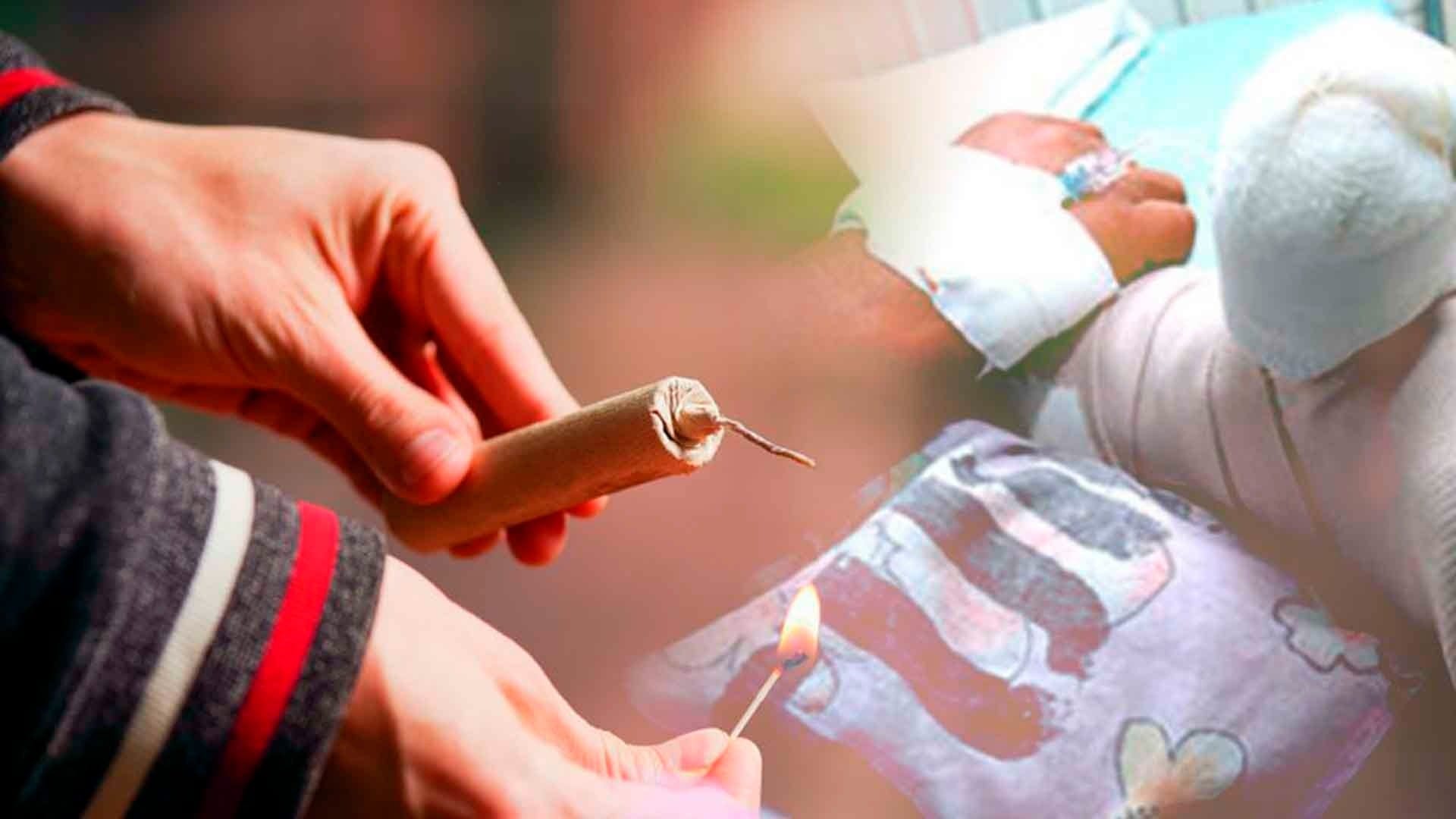 Un antes y un después es  la  marca indeleble de una quemadura con pólvora