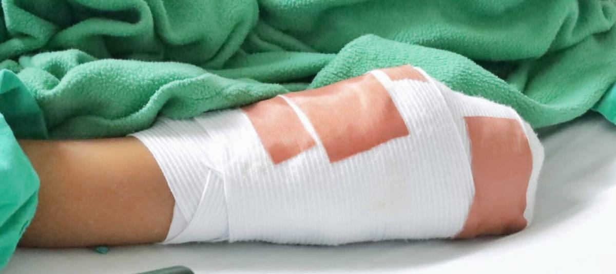 Perdió tres dedos, salió del hospital y horas después perdió un ojo