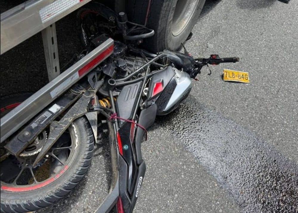 Un brazo cercenado de forma brutal lo ‘transportó’ a la tumba