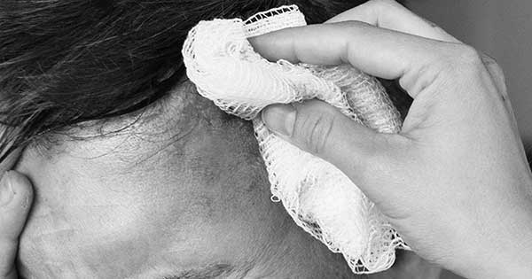 Le puso la plancha en la cabeza. Así terminó discusión entre una empleada domestica y su patrón