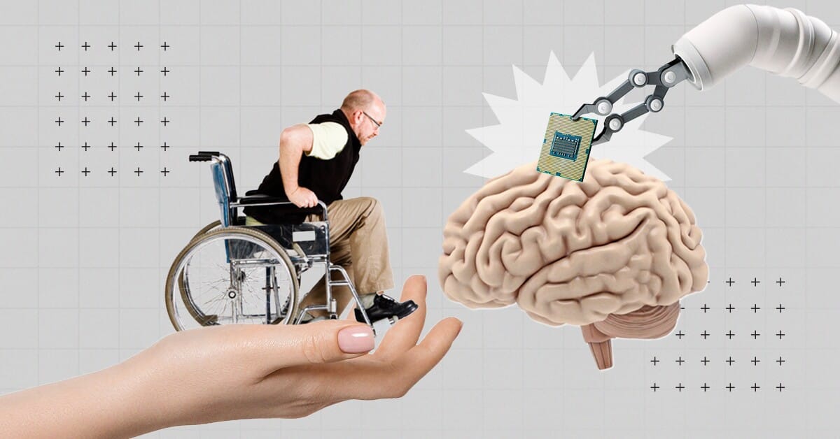 Nuevo chip cerebral autorizado para uso clínico abre competencia con Neuralink