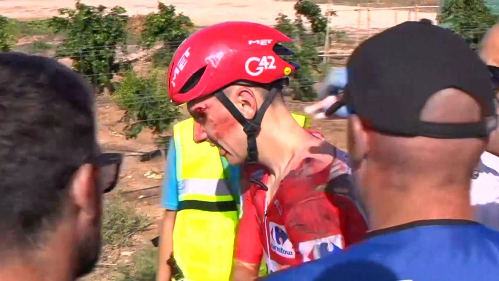 Tadej Pogačar abandona La Vuelta tras sufrir una dura caída y deja en suspenso su temporada