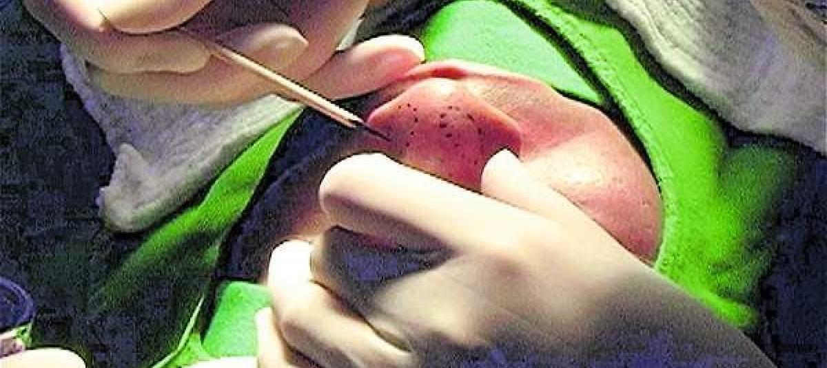 Confirman condena a mujer que realizó cirugía estética sin ser cirujana y causó deformidad permanente