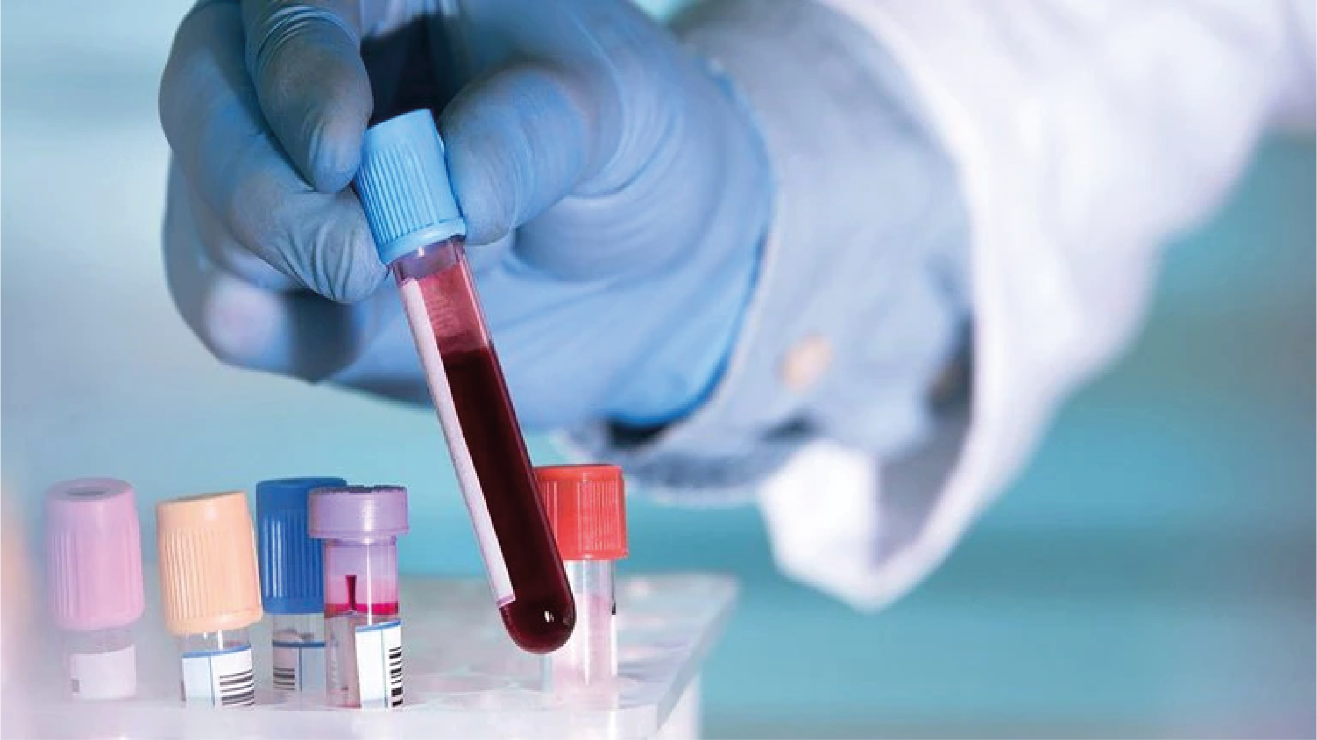 El revolucionario análisis de sangre que detecta cáncer en etapas tempranas imagen de la publicación