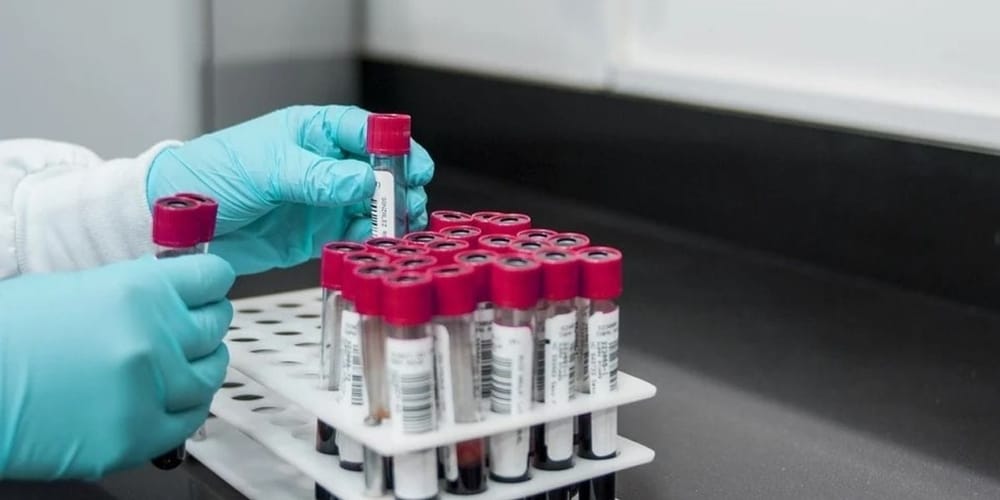 Alerta sanitaria en Santander por dengue: Se necesita cooperación de todos imagen de la publicación