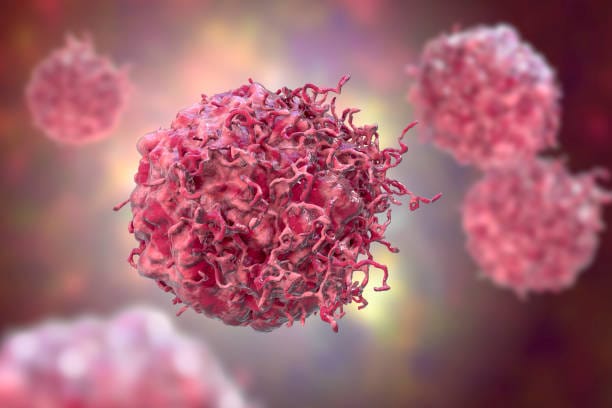 Sarcoma: La lucha contra el diagnóstico tardío en Colombia imagen de la publicación