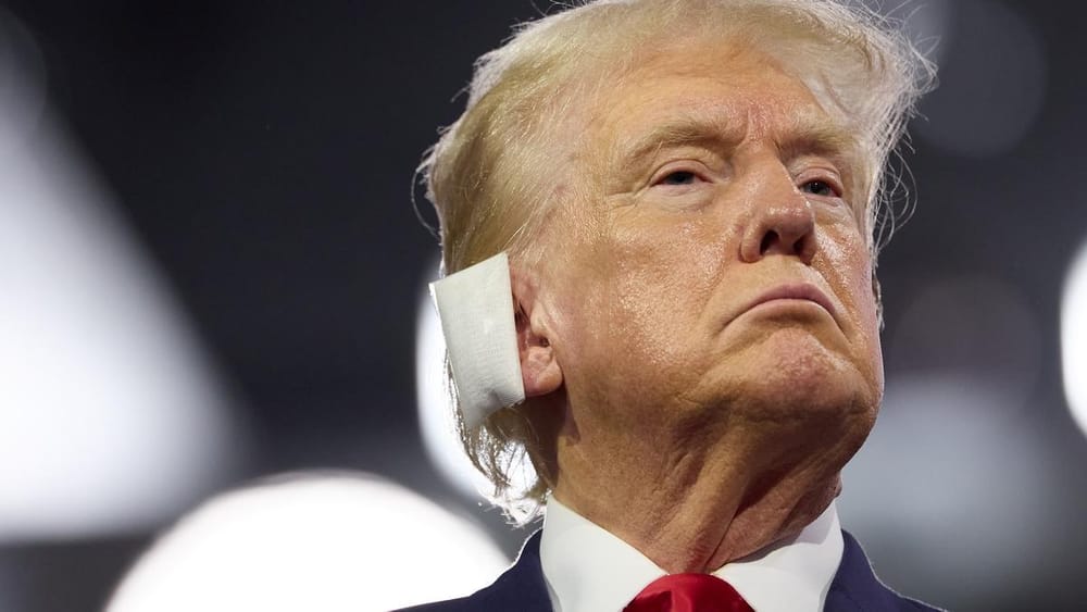 El doctor de Trump da detalles de la herida que casi le causa la muerte imagen de la publicación