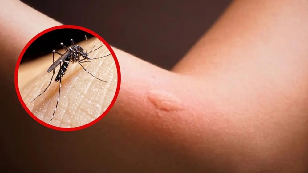 Santander supera a Antioquia y Bogotá en muertes por dengue imagen de la publicación