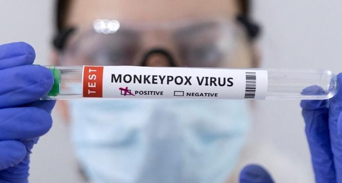 Expertos UDES abordan medidas de protección y datos claves de la viruela del mono imagen de la publicación