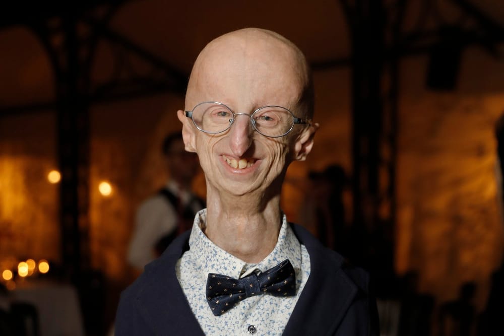 Fallece Sammy Basso, el joven científico que desafió la progeria y vivió 28 años imagen de la publicación