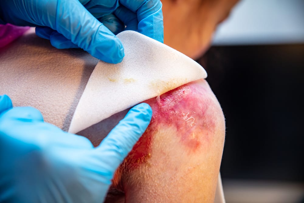 La Epidermólisis Bullosa y el poder transformador de la tecnología imagen de la publicación