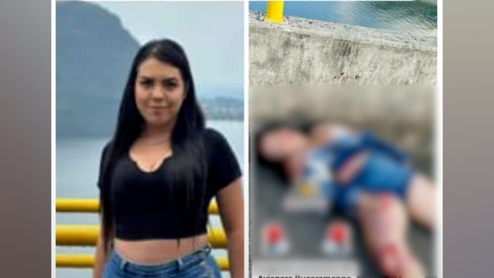 Mujer herida en accidente de ‘piques’ perdió batalla con la muerte imagen de la publicación