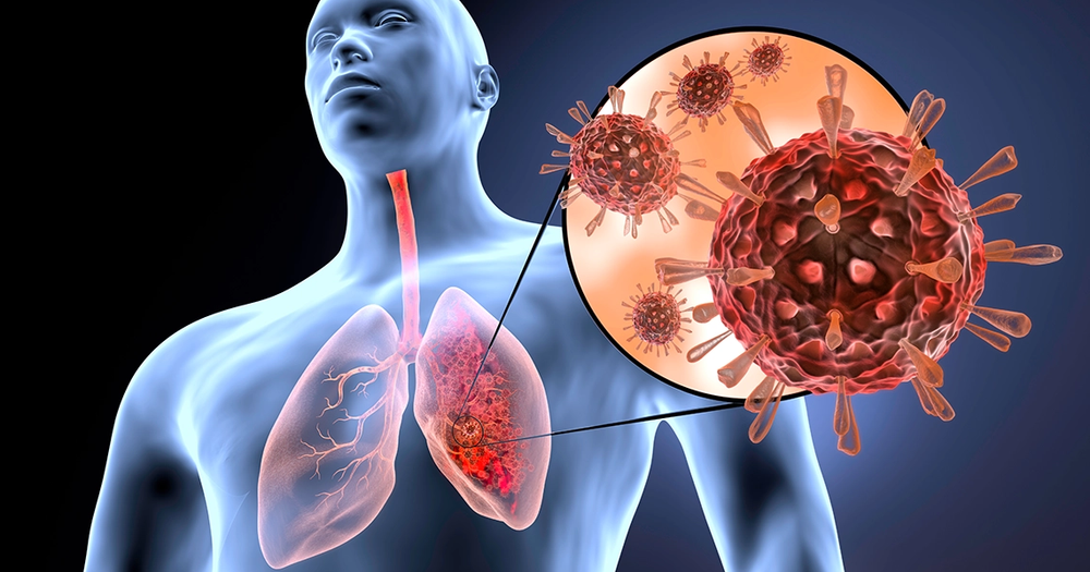 Aumentan infecciones respiratorias en Santander imagen de la publicación