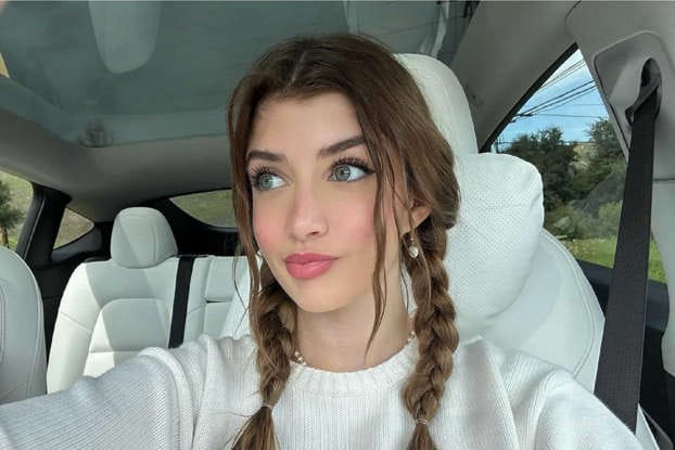 Hija de Charlie Sheen reveló que se ha hecho múltiples cirugías estéticas imagen de la publicación