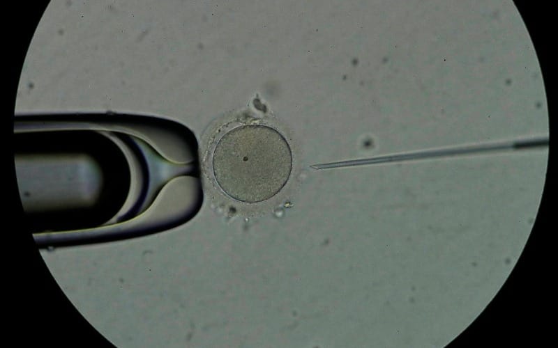 Maduración in vitro de óvulos: una nueva era en la medicina reproductiva imagen de la publicación