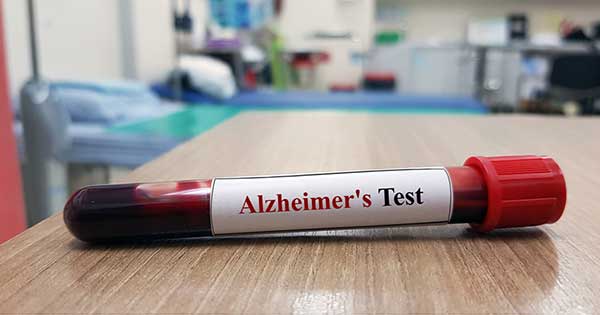Validan prueba de sangre con más del 90% de precisión en detección precoz del Alzheimer imagen de la publicación
