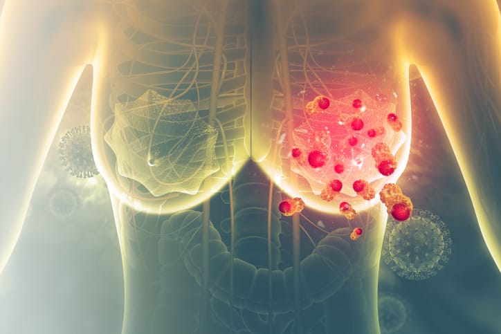“EPS e IPS deben trabajar en la detección del cáncer de mama y cuello uterino” imagen de la publicación