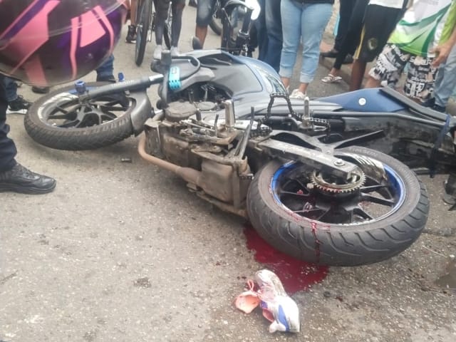 Un rápido y arriesgado rescate de pierna de accidentada en Bucaramanga imagen de la publicación