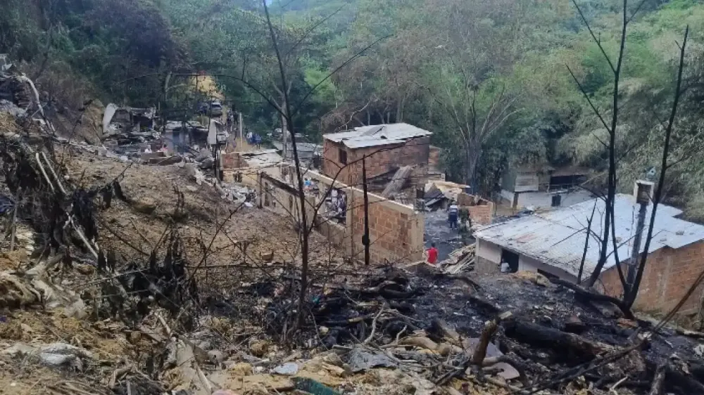 Amputan extremidad a víctima del incendio del 12 de Octubre, Bucaramanga imagen de la publicación