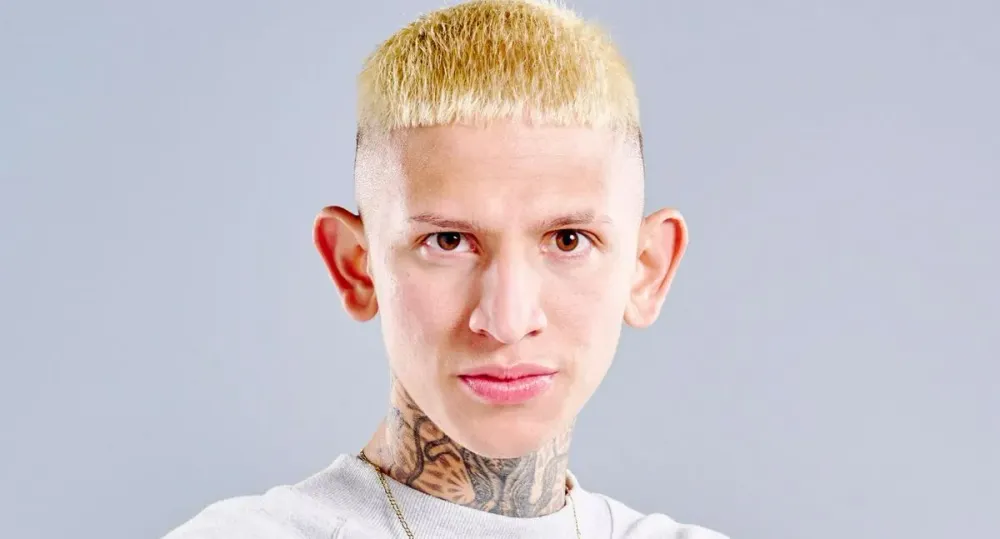 La Liendra anuncia retoque estético y genera debate en redes sociales imagen de la publicación