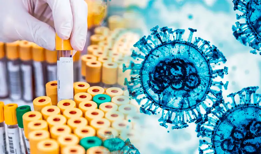 Alerta máxima por desaparición de muestras de virus de alta peligrosidad imagen de la publicación