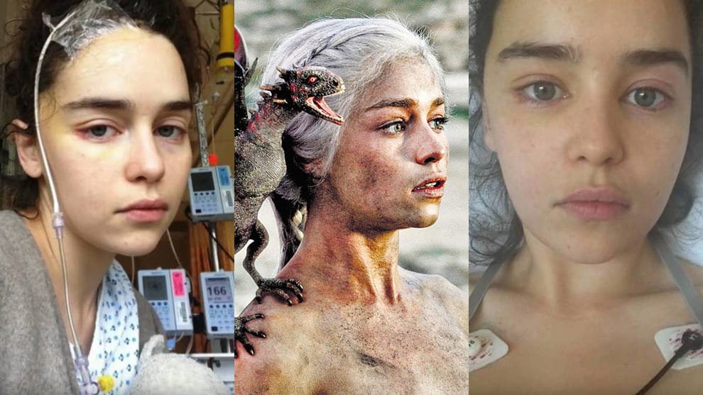 Emilia Clarke revela el duro impacto emocional y físico que dejaron los aneurismas que sufrió durante “Game of Thrones” imagen de la publicación