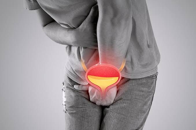 Hasta el 18 % de los hombres en Colombia padecen vejiga hiperactiva y muchos desconocen sus síntomas imagen de la publicación