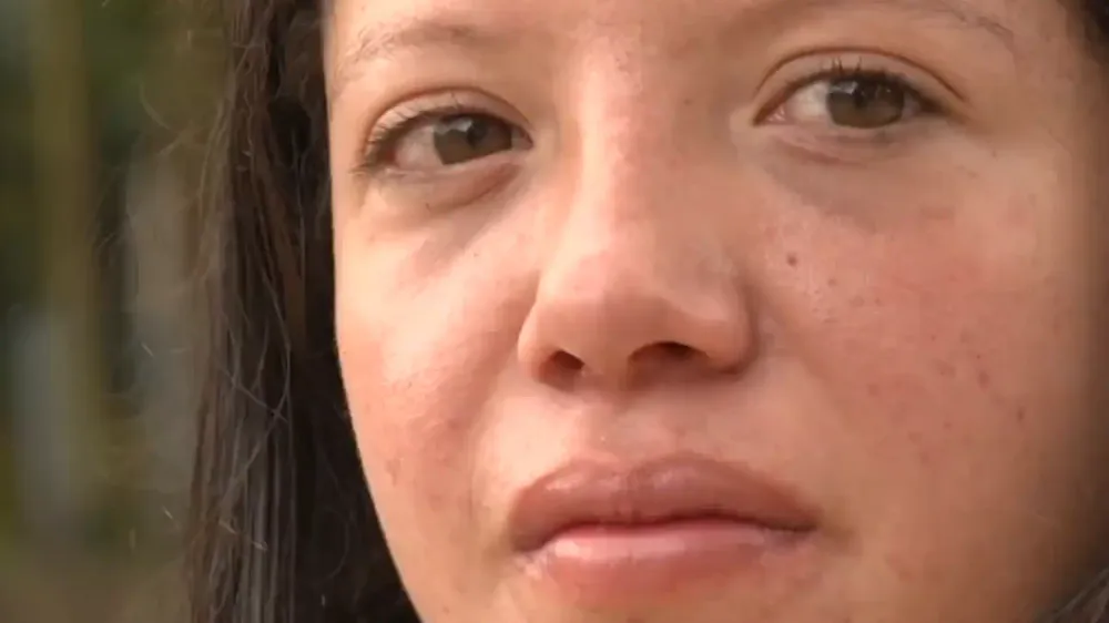 Joven santandereana perdió un oído por tumor y ahora pide ayuda para volver a ser operada imagen de la publicación
