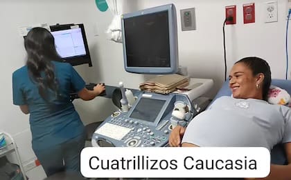 En Medellín pareja tuvo cuatro bebés que podrían ser genéticamente idénticos imagen de la publicación