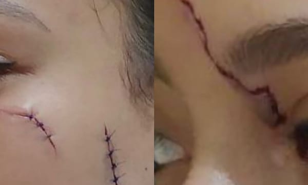 Intolerantes borrachos apuñalan a joven en la cara mientras este intentaba evitar una pelea