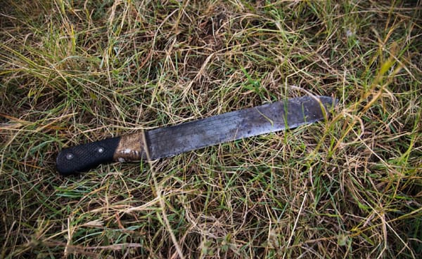 ¡Desgarrador! mujer de 50 años fue atacada con machete por su exesposo en Landázuri