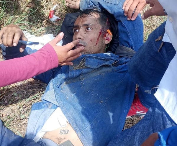 Grave accidente de motocicleta en la rotonda de El Palenque en Bucaramanga