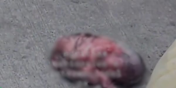 VIDEO. Perro fue visto con un feto humano en sus dientes