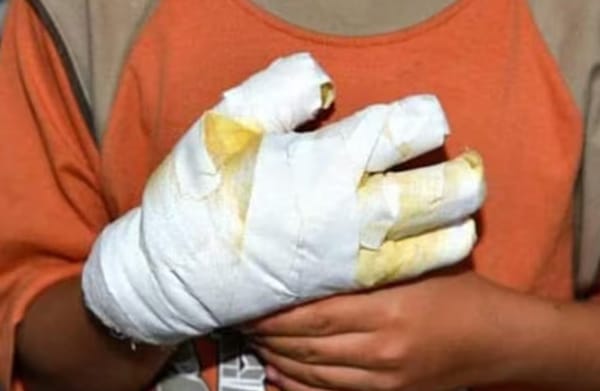 Primer quemado por pólvora en Bucaramanga es un niño