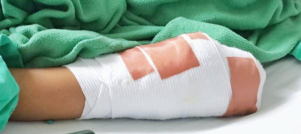 Perdió tres dedos, salió del hospital y horas después perdió un ojo
