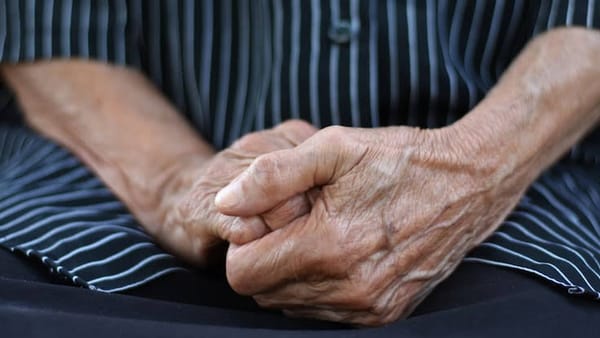Adulto mayor fue brutalmente golpeado en Piedecuesta tras reclamar exceso de ruido a sus vecinos