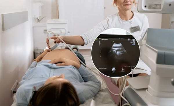 Chile debate proyecto que obligaría a escuchar los latidos del feto antes de un aborto legal