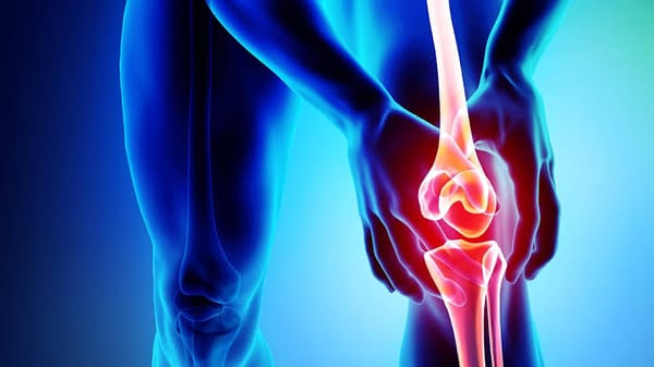 Osteoartritis, la enfermedad silenciosa que deteriora las articulaciones