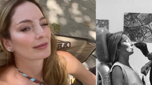Claudia Bahamón sufrió fractura de nariz durante las grabaciones de ‘MasterChef Celebrity’