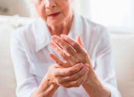 Llega a Colombiaun avance que marca el inicio de la medicina personalizada en artritis reumatoide imagen de la publicación