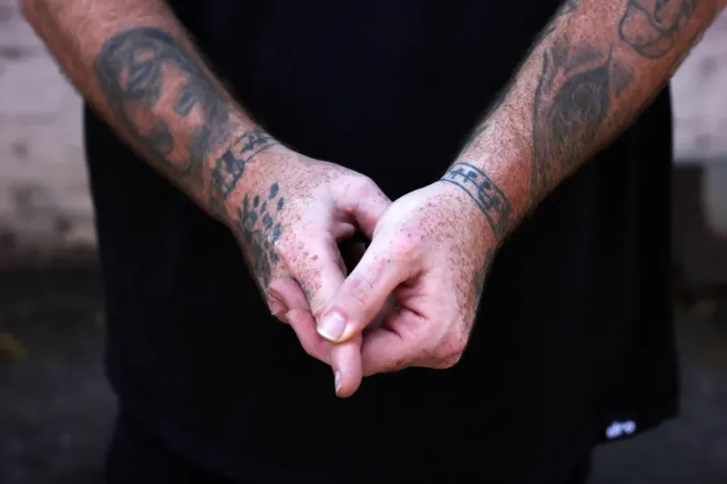 De la vergüenza al orgullo: conozca al hombre que convirtió su micropene en sinónimo de valentía y ahora está en los Guinness imagen de la publicación