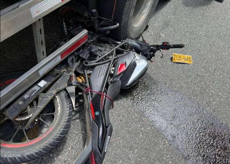 Un brazo cercenado de forma brutal lo ‘transportó’ a la tumba imagen de la publicación